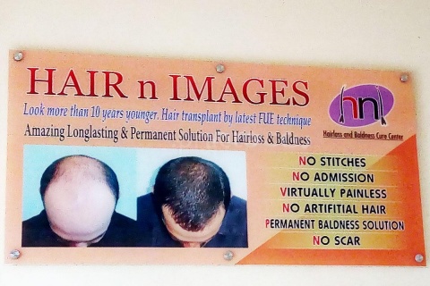 Hair N Images - Hair Transplant Clinic In Surat