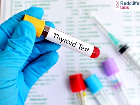 Thyroid Test in Delhi - Redcliffe Labs