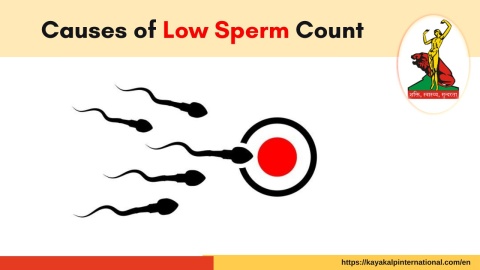 Doctors for Low Sperm Count Treatment in Mumbai