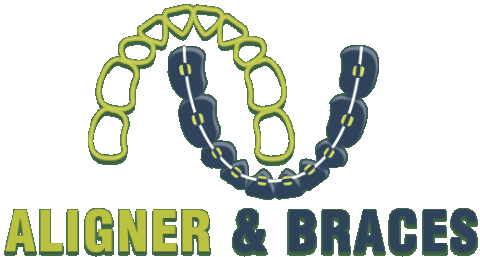 Aligner and Braces