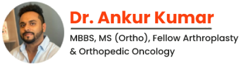 Dr. Ankur Kumar | Best Orthopedic Surgeon
