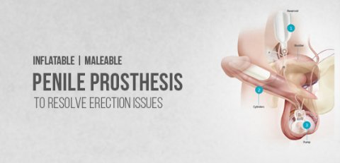 Penile Prosthesis Surgery In Bangalore | Worldofurology