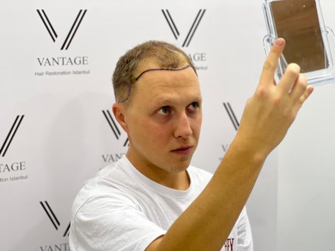 Vantage Hair Clinic