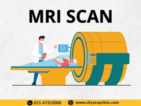 MRI Scan Near me In Delhi At Reasonable Price