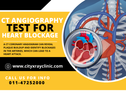 CT Coronary Angiography Scan Near Me In Delhi At Best Price
