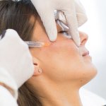 حقن الياقوت