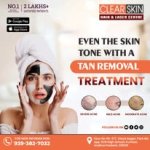 Clear Skin Hair & Laser Centre