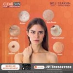 Clear Skin Hair & Laser Centre