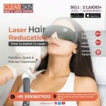 Clear Skin Hair & Laser Centre