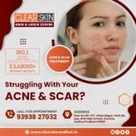 Clear Skin Hair & Laser Centre