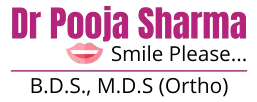 Invisalign Treatment in Agra. Clear Aligners in Agra