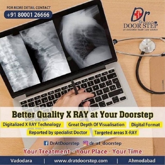 Best X Ray Centres in Ahmedabad | Doctor at Doorstep