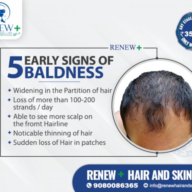 Renew+ Hair and Skin Care Clinic Madurai