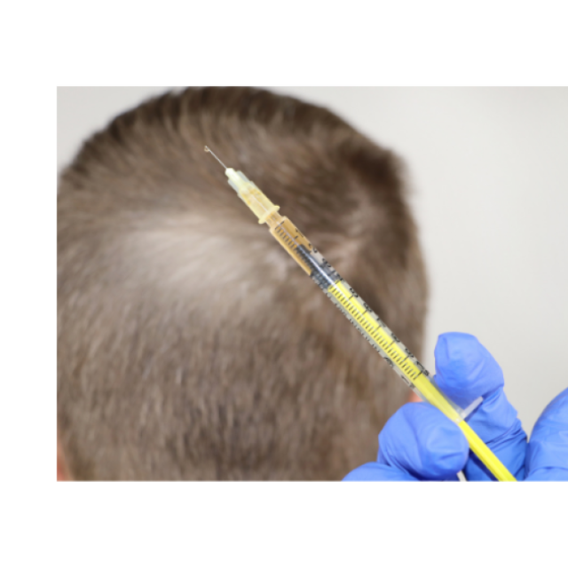 Hairgraaft Hair Transplant Clinic Kerala |Non Surgical  Hair Loss Treatment