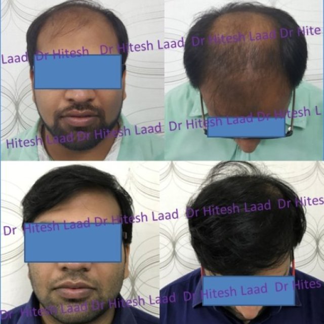 Authentic Hair Transplant & Cosmetic Centre
