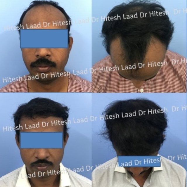 Authentic Hair Transplant & Cosmetic Centre