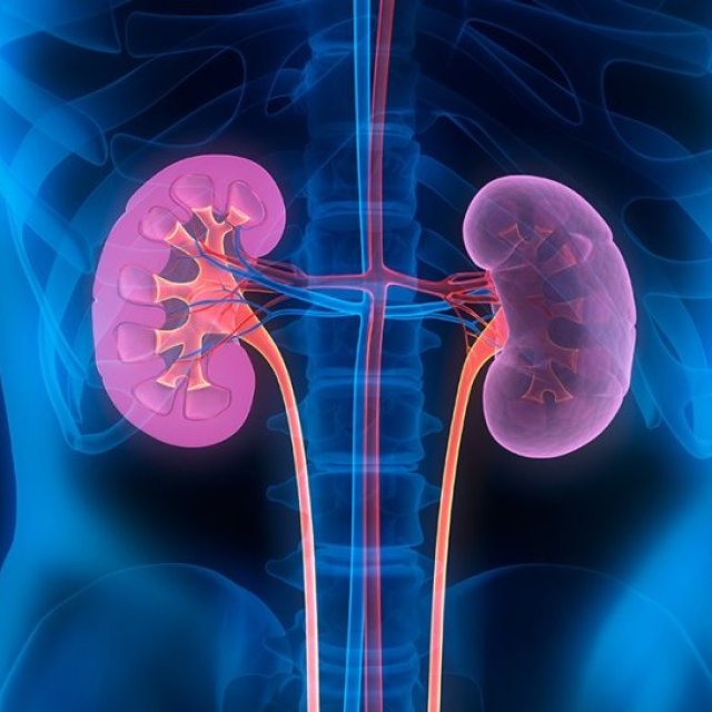 Kidney cancer treatment in Delhi - The Urethra Clinic