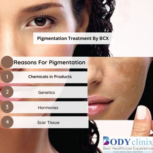 Pigmentation Treatment in Delhi : Body clinix