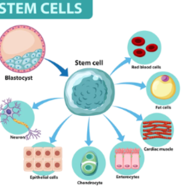 Stem Cell Transplant in India
