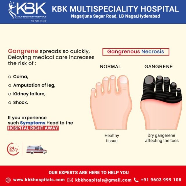 KBK Hospitals