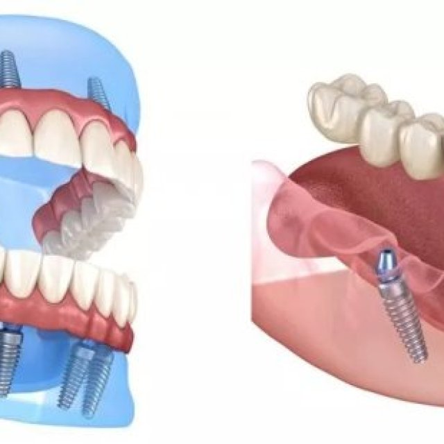 Advanced Dental Implants Institute
