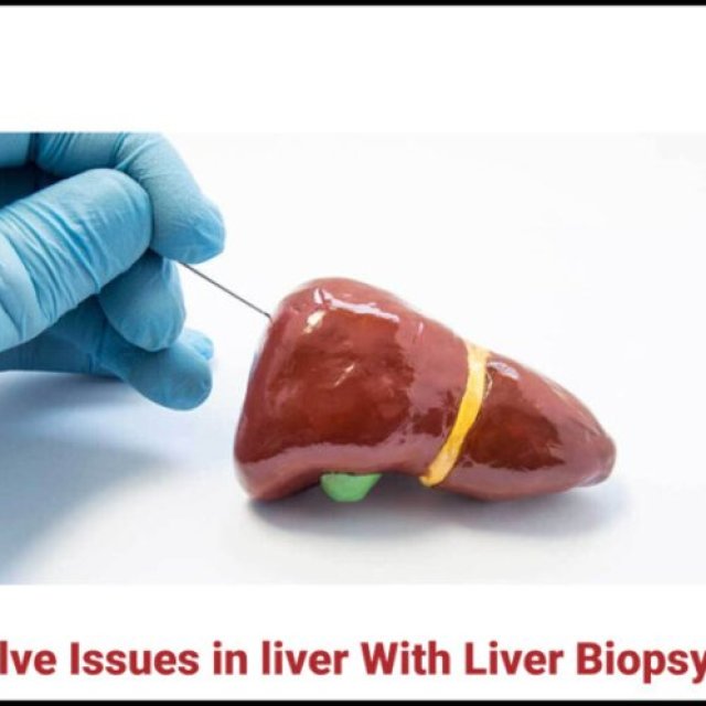 How to Solve Issues in Liver With Liver Biopsy procedure in Hyderabad