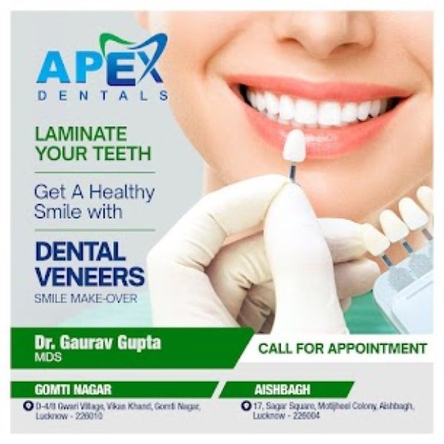 Apex Dentals