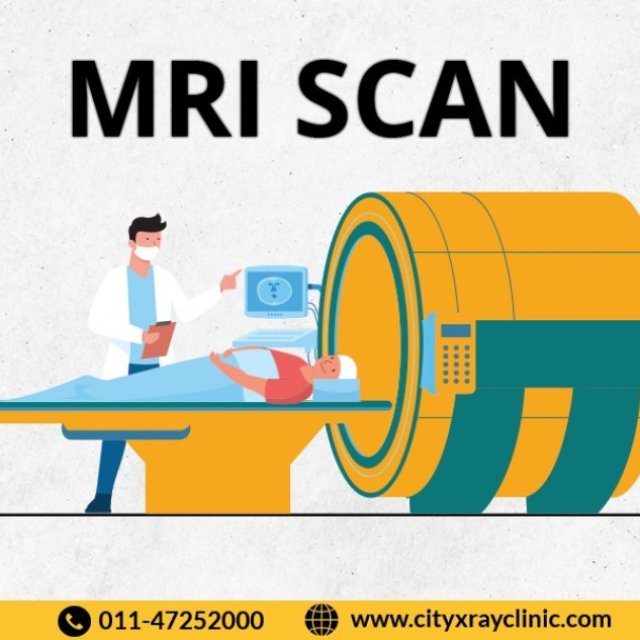 MRI Scan Near me In Delhi At Reasonable Price