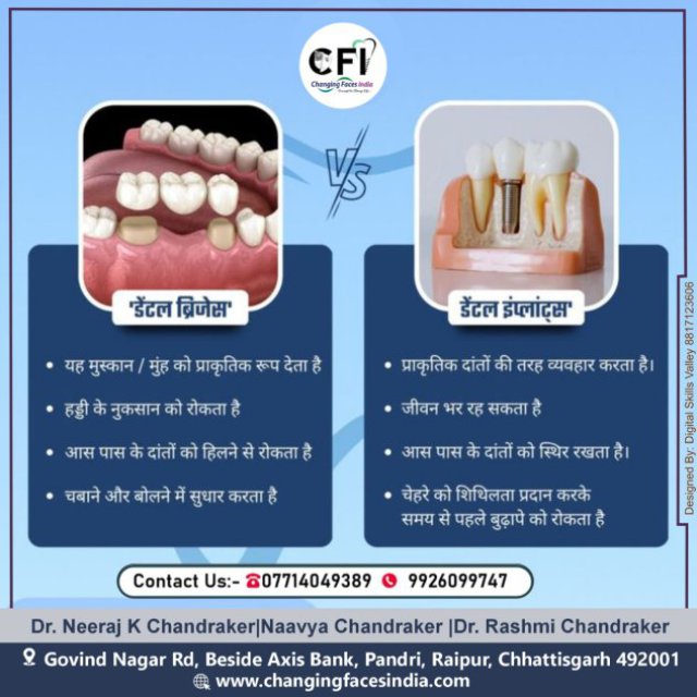 Dr. Neeraj Chandraker | Maxillofacial Consultant in Raipur | Best Prosthodontist Consultant in Raipur