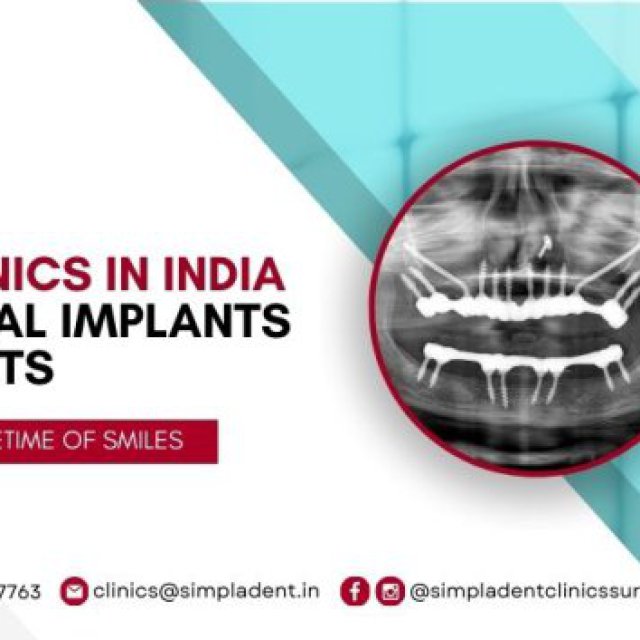 Best Implantologist Doctors in Surat