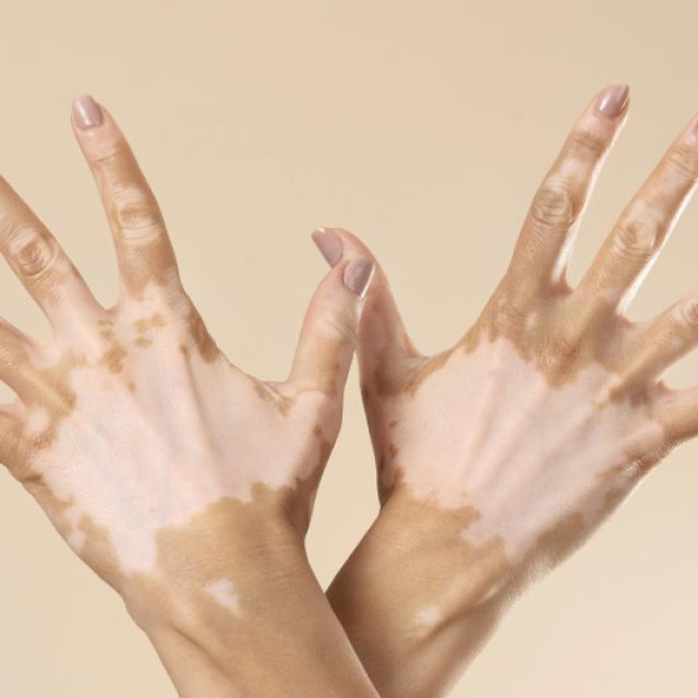 Dermaconsult Clinic
