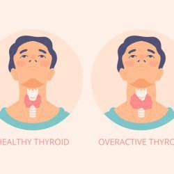 Homeopathy Treatment For Thyroid Disorders