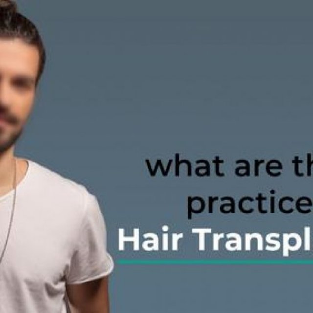 Best hair transplant treatment in delhi